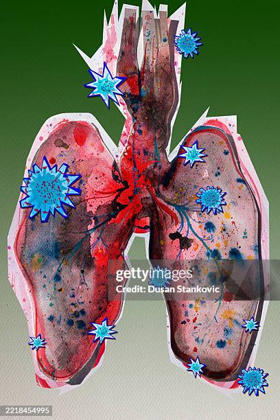 Cancer Abstract Form Lung Cancer Abstract High-Res Vector Graphic - Getty Images