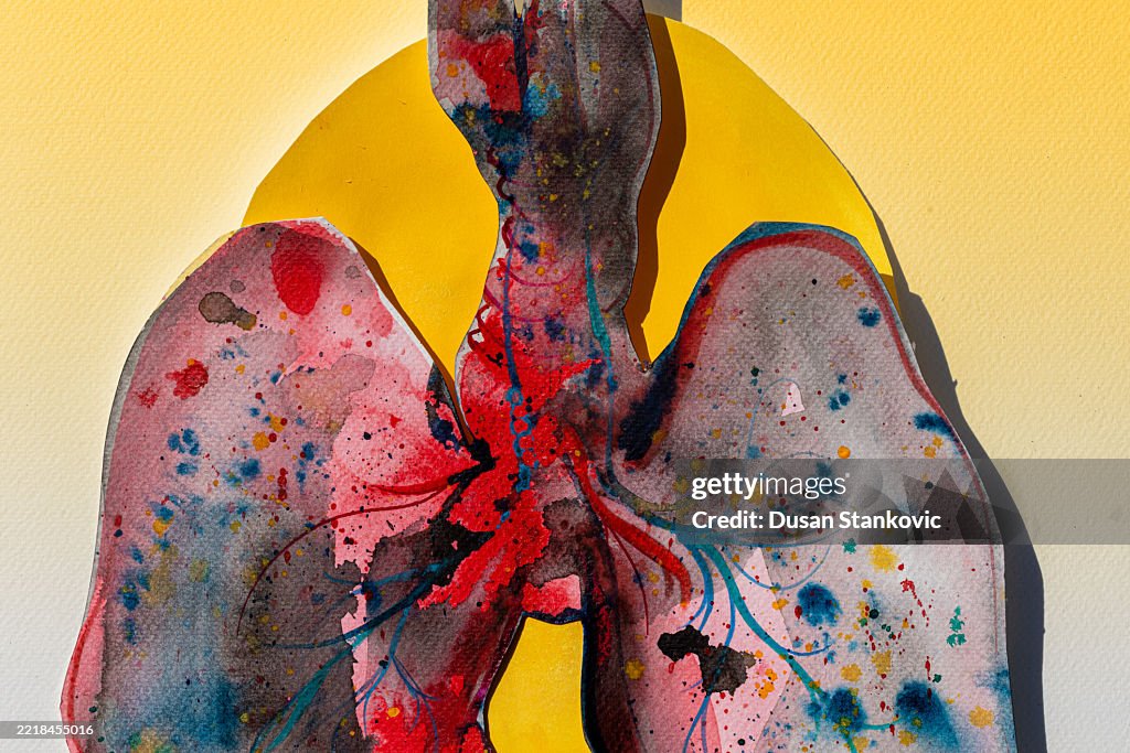 Abstract Medizinische Kunst: Lungentumor