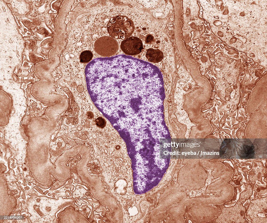 Basement membrane of mesangium