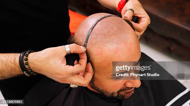 Barber Measuring 174 Male Hair Restoration Stock Photos, High-Res Pictures, and Images ...