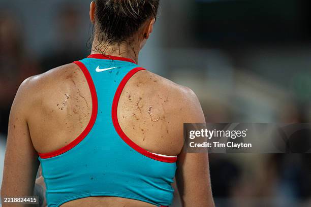 Aryna Sabalenka showing her clay splattered back against Iga Swiatek of Poland in the semi-final of the Women's singles competition on Court...
