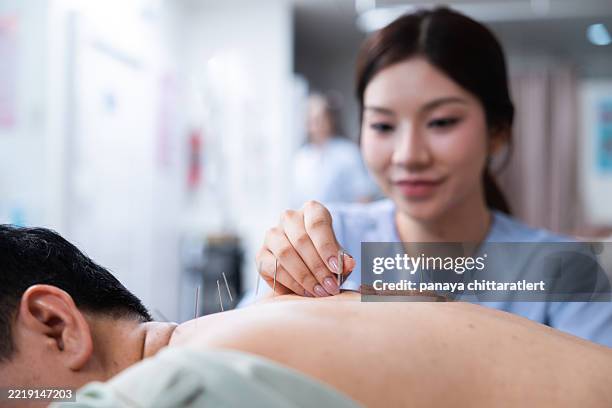 performing acupuncture on a patients back.a close-up of a patient receiving acupuncture an treatment on the back.acupuncture back treatment. - acupuncture needle stock pictures, royalty-free photos & images