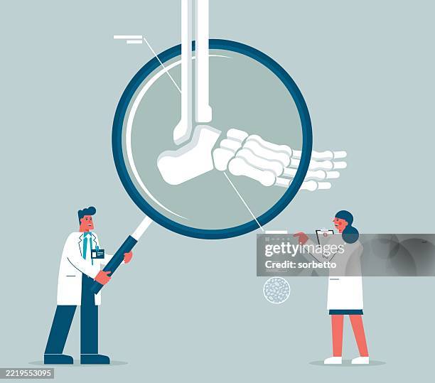 bone - ankle surgery stock illustrations