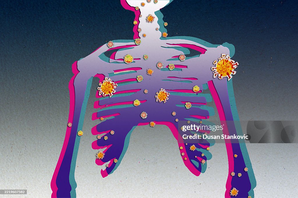 Esqueleto bajo ataque bacteriano