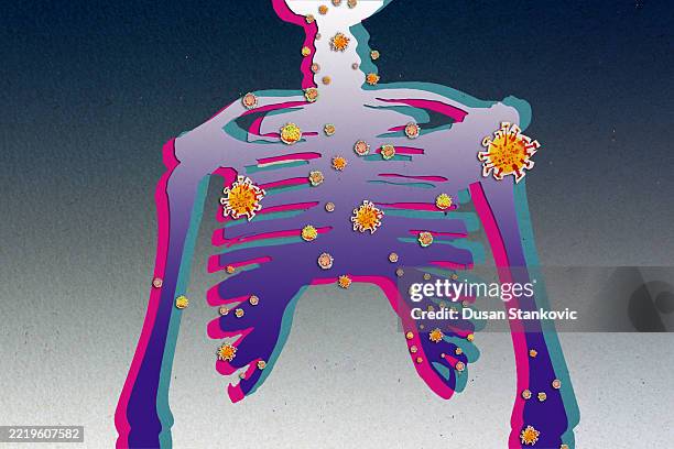 ilustrações de stock, clip art, desenhos animados e ícones de skeleton under bacterial attack - organismo acidófilo