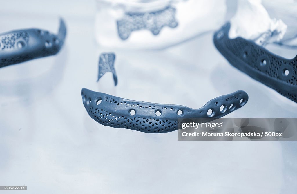 Facial bone lower human jaw individual prototype printed 3 D printer