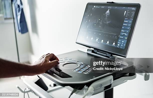 medico che utilizza la macchina ad ultrasuoni nella clinica medica - apparecchiatura medica foto e immagini stock
