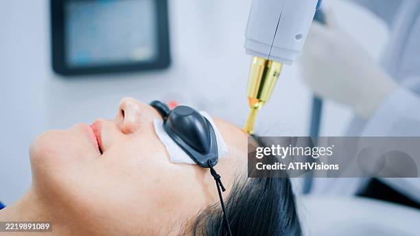séance de traitement au laser anti-âge dans une clinique de dermatologie moderne - irritation cutanée photos et images de collection