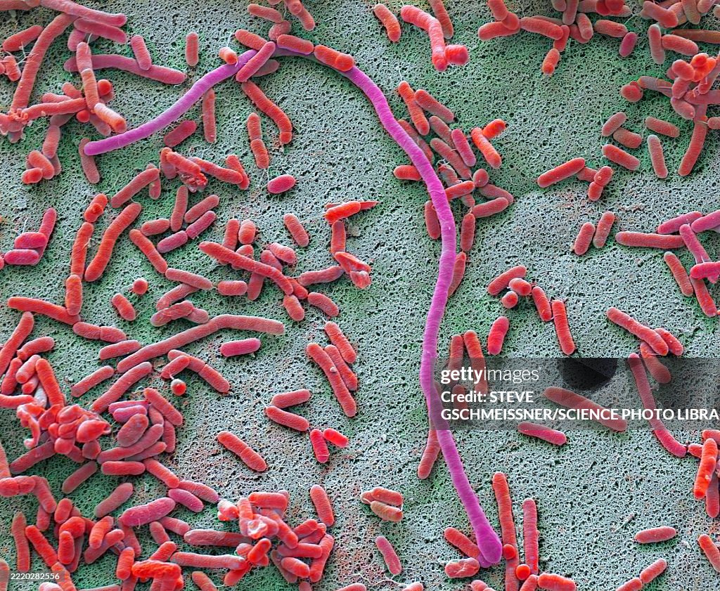 Dishcloth bacteria, SEM