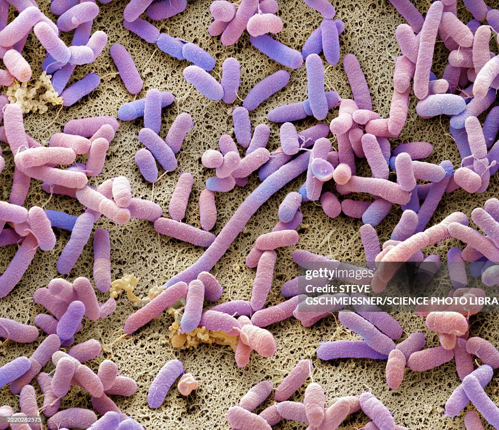 Dishcloth bacteria, SEM