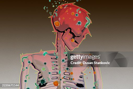 Skeleton Negative: Microbes Attacking Skeleton Negative: Microbes Attacking
