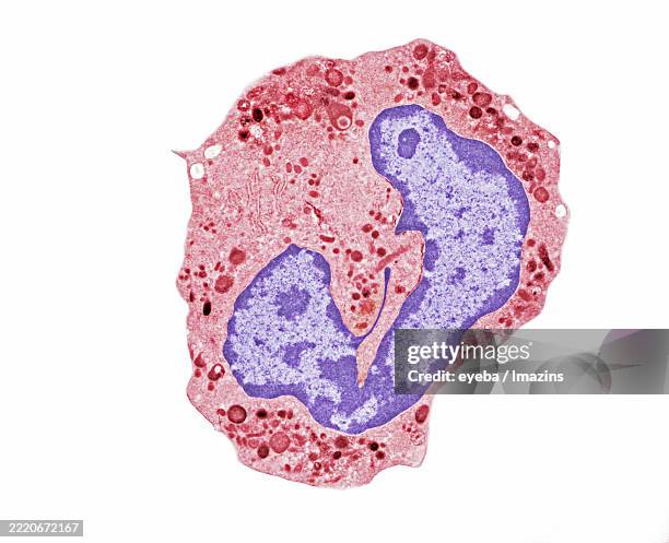 drum stick of a neutrophil - neutrophil stock pictures, royalty-free photos & images