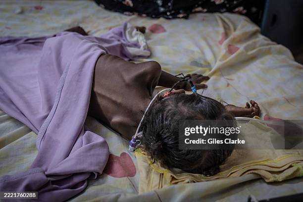 April 26, 2025. Two-year-old Riham Ata, who was admitted from a recently liberated area of Khartoum, lies on a gurney in one of Al-Buluk Hospital's...