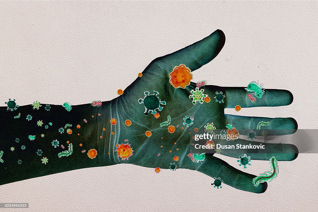 Large Infected Hand Touch And Infection High-Res Vector Graphic - Getty Images