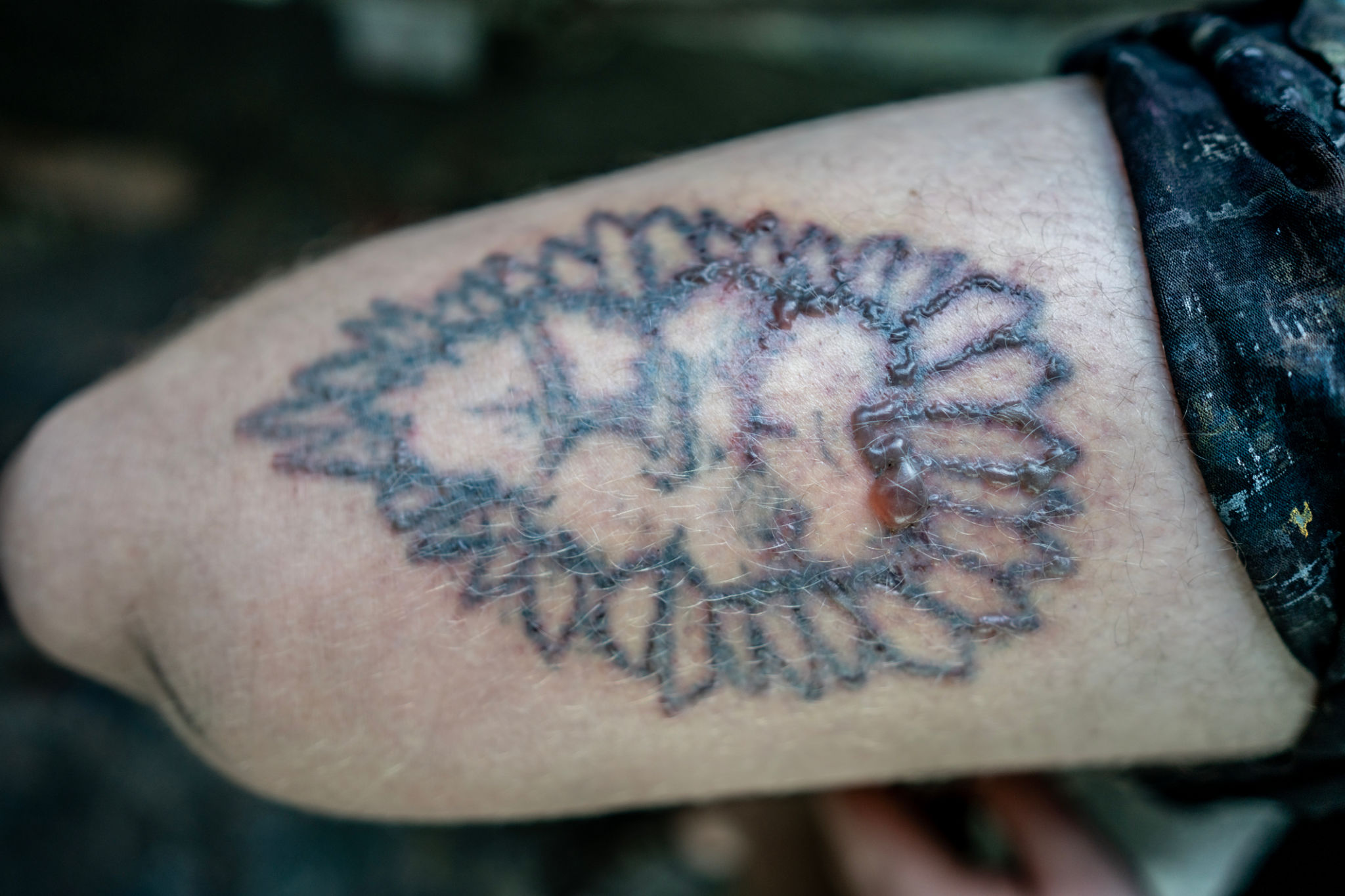 tatuaje enrojecido