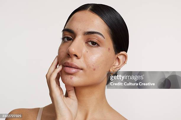 portrait of young woman looking at camera against white background - irritation cutanée photos et images de collection
