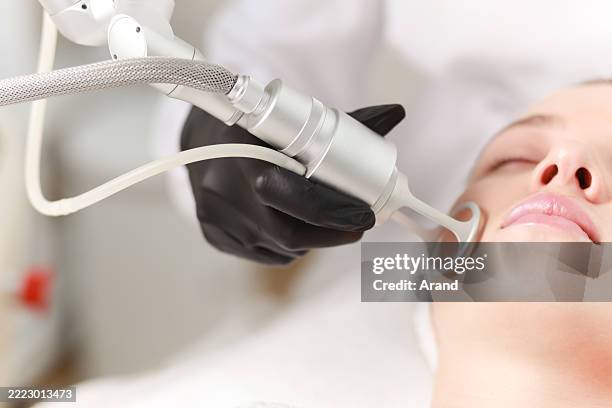 co2 carbon dioxide laser resurfacing cosmetology procedure - aparelho-de-soldar-a-laser imagens e fotografias de stock