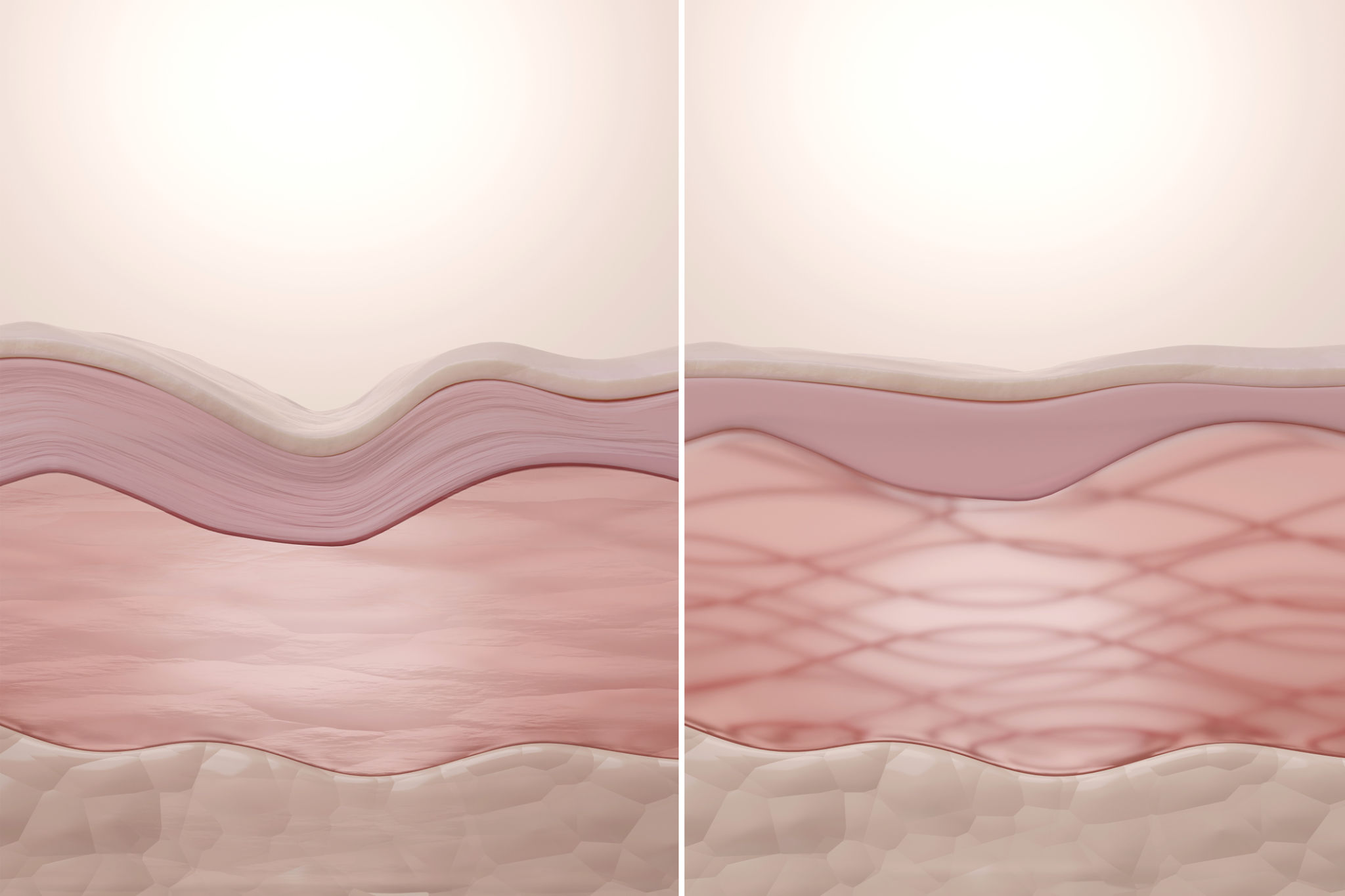 microneedling skin