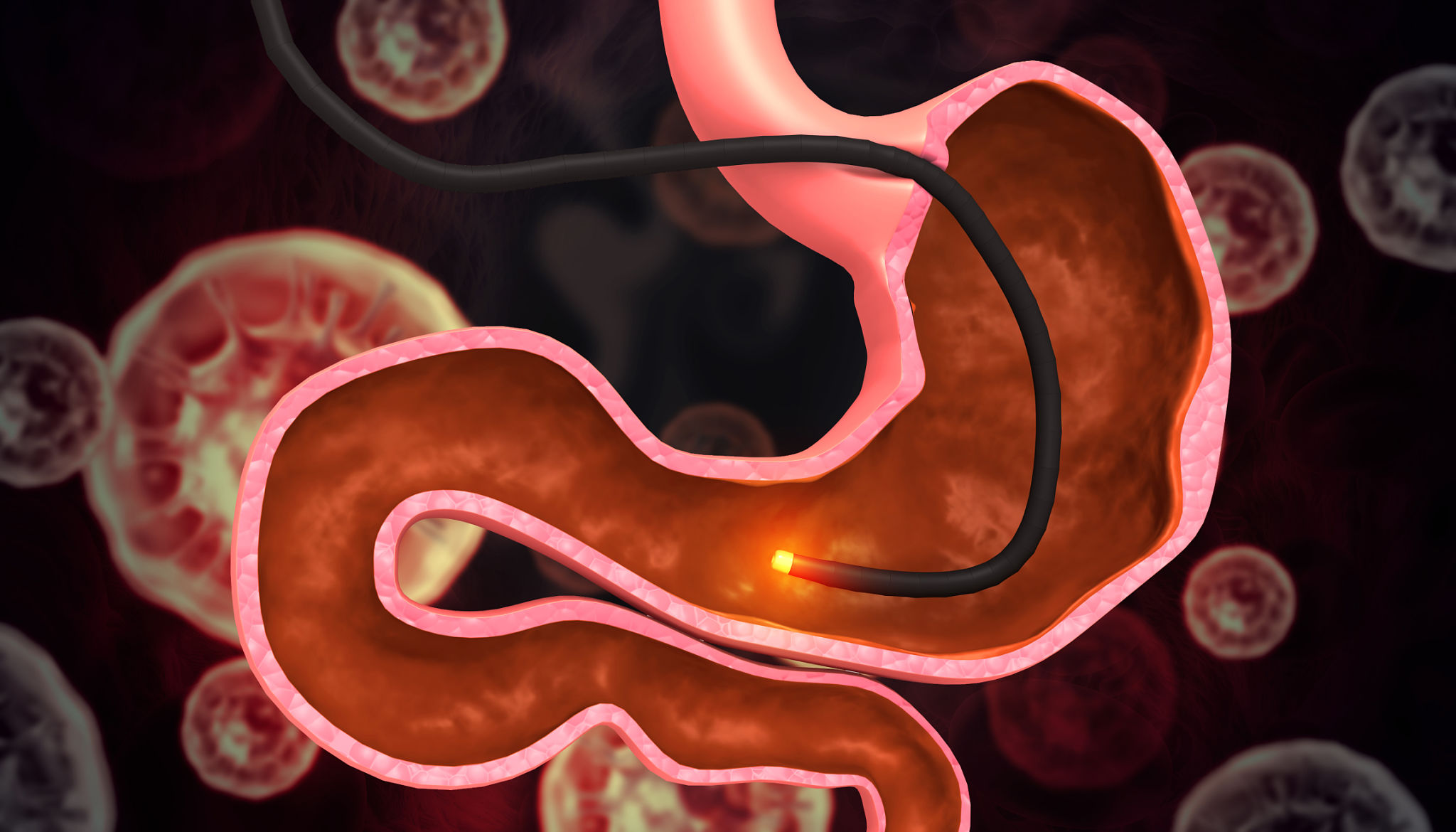 endoscopy procedure