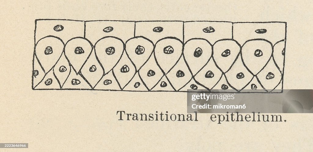 Old engraved illustration of transitional epithelium, a specialized type of stratified epithelium found in the urinary tract
