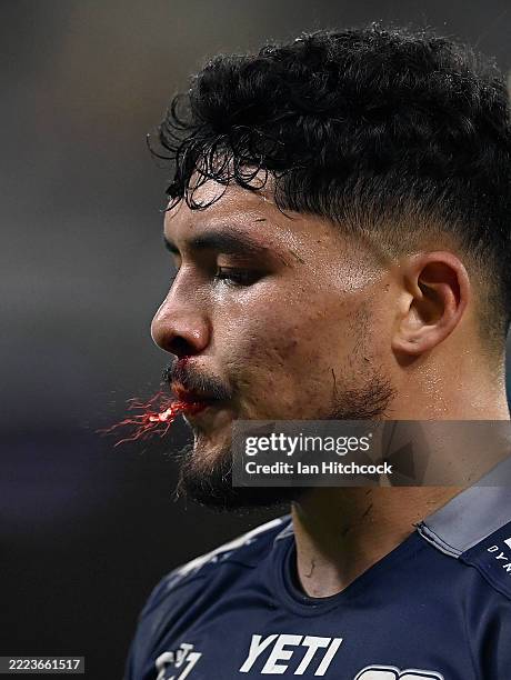Temple Kalepo of the Cowboys comes from the field injured during the round 18 NRL match between North Queensland Cowboys and Melbourne Storm at...