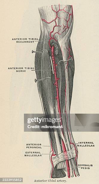 Tibia Ulcer 271 Leg Ulcer Stock Photos, High-Res Pictures, and Images - Getty Images