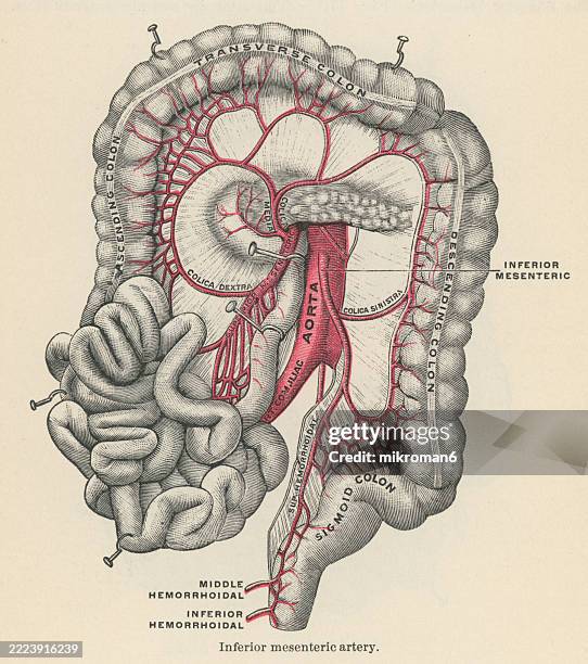 Modelo De Arteria Mesentérica Inferior Origen De La Arteria
