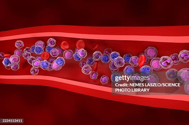 diffuse large b-cell lymphoma, illustration - b cells stock illustrations