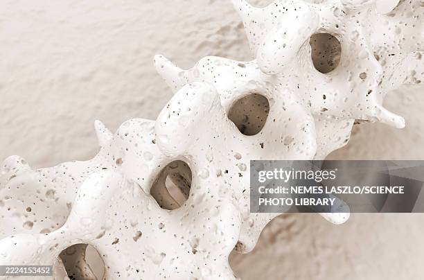 osteoporosis of the spine, illustration - osteoporose stock-grafiken, -clipart, -cartoons und -symbole