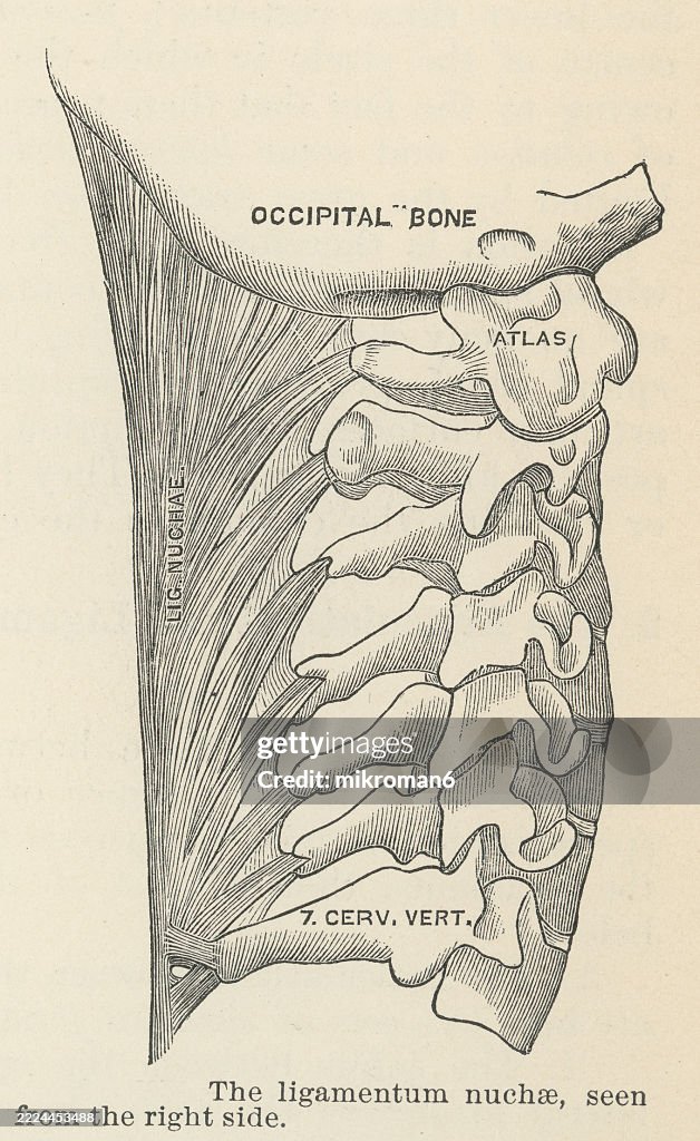Old engraved illustration of human ligaments - the nuchal ligament, a ligament at the back of the neck that is continuous with the supraspinous ligament