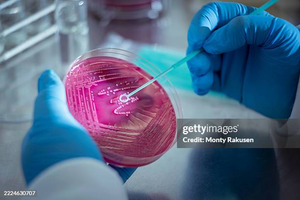 scientist sweeping petri dish containing bacterial growth in laboratory - boîte de pétri photos et images de collection