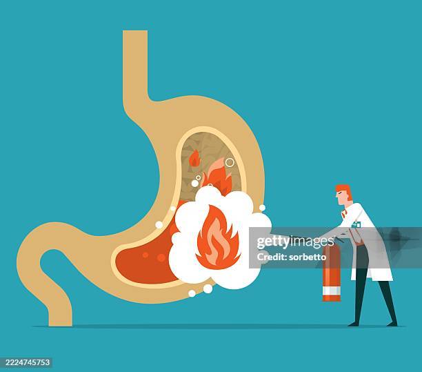 stomach heartburn - acid reflux stock illustrations