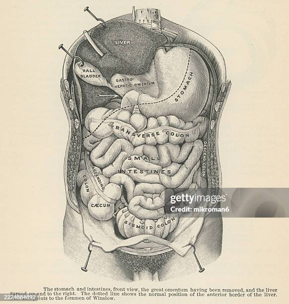 old engraved illustration of the stomach and intestines, front view - ilustración biomédica fotografías e imágenes de stock