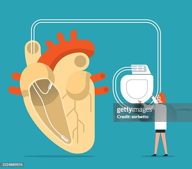heart pacemaker - female doctor - electrode stock illustrations