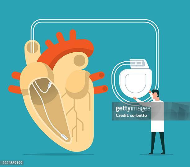 Cartoon Pacemaker Doctor Heart Pacemaker Male Doctor High-Res Vector Graphic - Getty Images