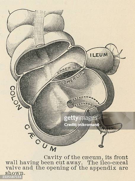 Cecenum 1,032 Cecum Stock Photos, High-Res Pictures, and Images - Getty Images