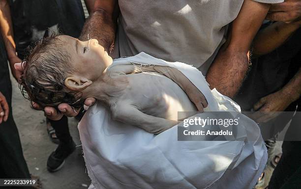 Man carries the starved body of 4-month-old Yahya al-Najjar who died of severe malnutrition as food crisis continues due to Israeli blockade, in Khan...