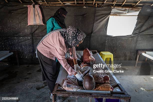 January 19, 2025. Dr. Omnayat El Toom treats an elderly cholera patient in the MSF Cholera Clinic at the Minaa El Bari IDP Site in Gedaref. In August...