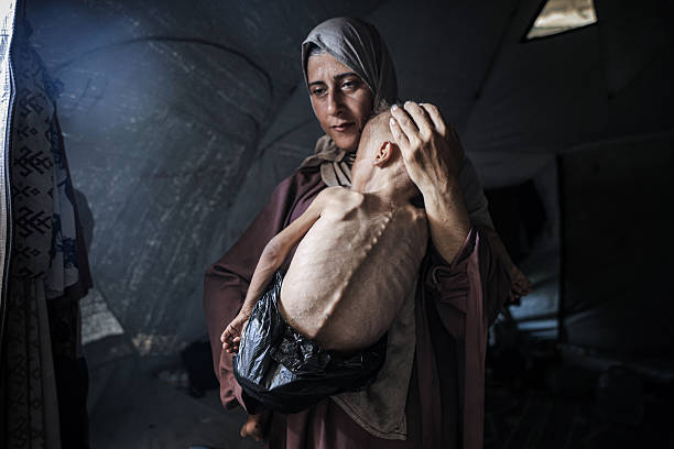 Muhammad Zakariya Ayyoub al-Matouq, a 1.5-year-old child in Gaza City, Gaza, faces life-threatening malnutrition as the humanitarian situation...