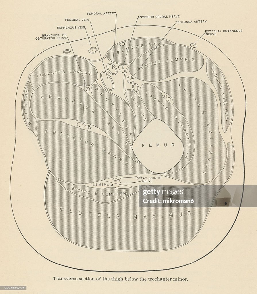 Old engraved illustration of transverse section of the thigh below the trochanter minor