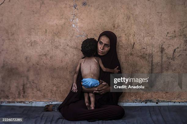 Year-old Palestinian Yezen Abu Ful, whose health has deteriorated due to lack of access to food and nutritional supplements, is seen with his mother...