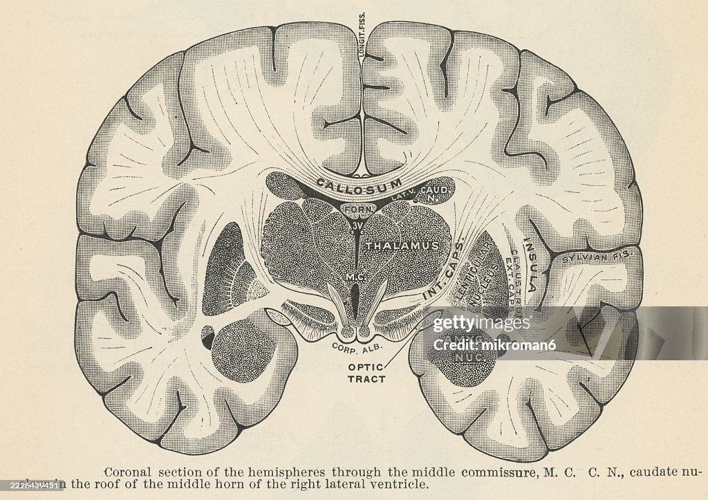 Old engraved illustration of anatomy - coronal section of the hemispheres through the middle commissure
