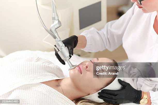 co2 carbon dioxide laser resurfacing cosmetology procedure - aparelho-de-soldar-a-laser imagens e fotografias de stock
