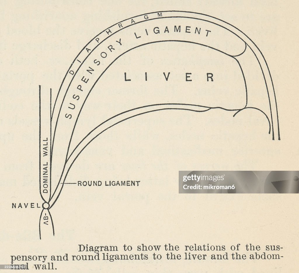 Old engraved illustration of diagram to show the relations of the suspensory and round ligaments to the liver and the abdominal wall