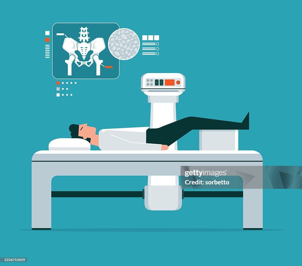 Bone Density Scan