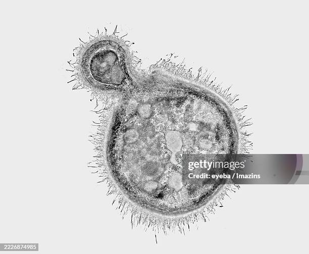 Cryptococcus Drawing 47 Cryptococcus Neoformans Stock Photos, High-Res Pictures, and Images ...