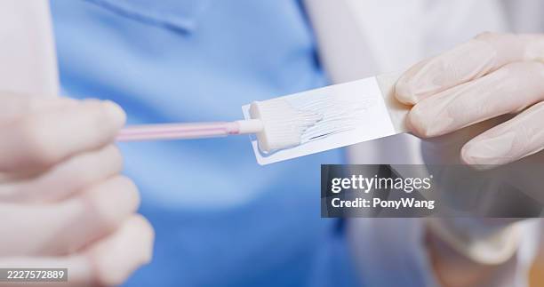 placing cervical sample on glass slide - colposcopy stock pictures, royalty-free photos & images