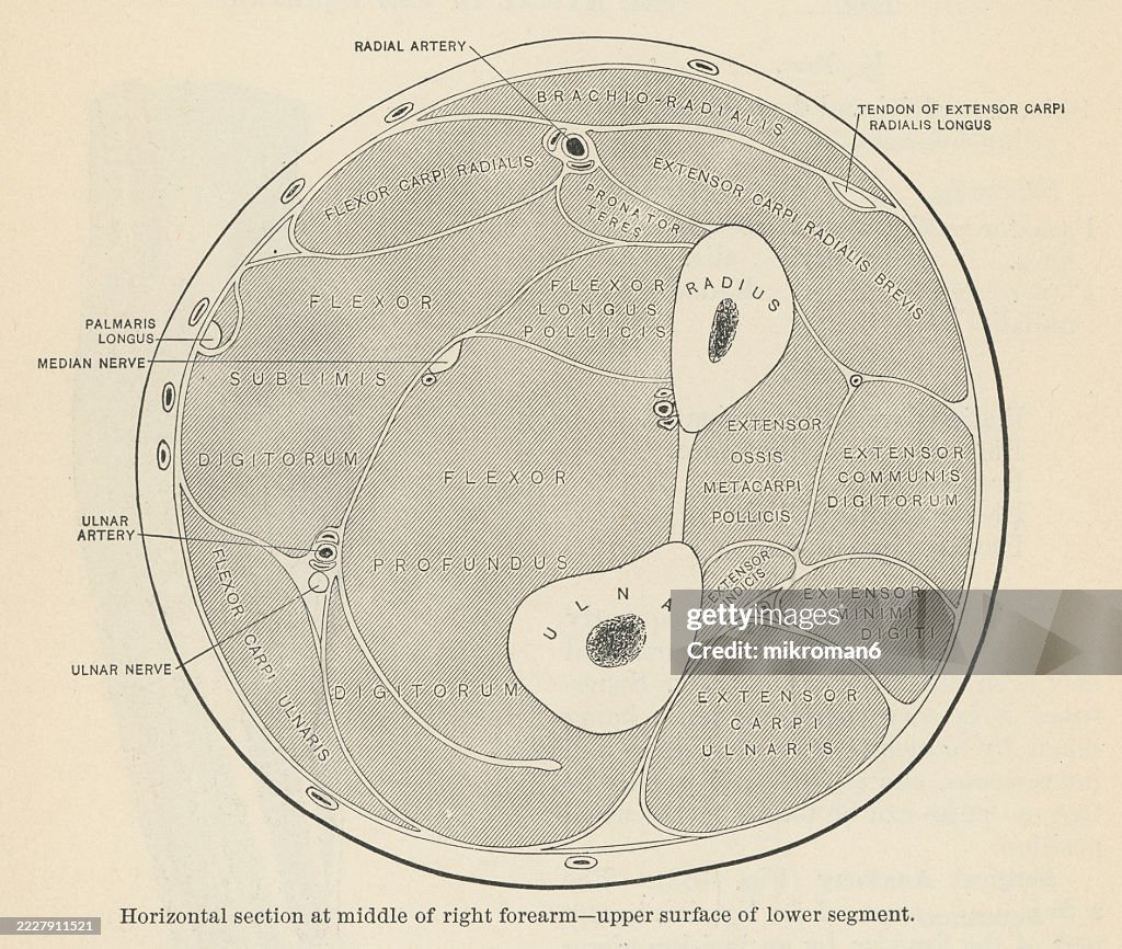 Old engraved illustration of horizontal section at middle of right forearm (upper surface of lower segment)