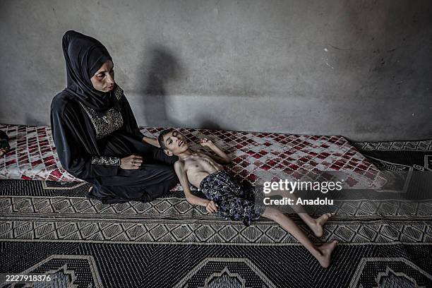 Twelve-year-old Fadi Abu Halima, who is battling muscular dystrophy, is suffering from severe malnutrition due to Israel's ongoing attacks and...