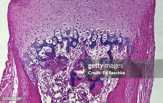 Endochondral Bone Ossification--Developing Bone showing the Epiphyseal Disk (Growth Plate), 25X Endochondral Bone Ossification--Developing Bone showing the Epiphyseal Disk (Growth Plate), 25X